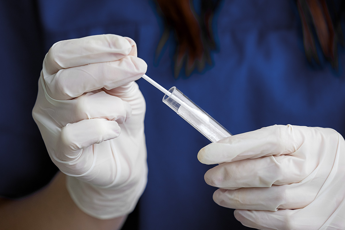 STI test stock photo